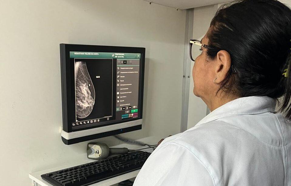 Câncer de mama: confira o passo a passo para fazer mamografia gratuita pelo SUS no Piauí