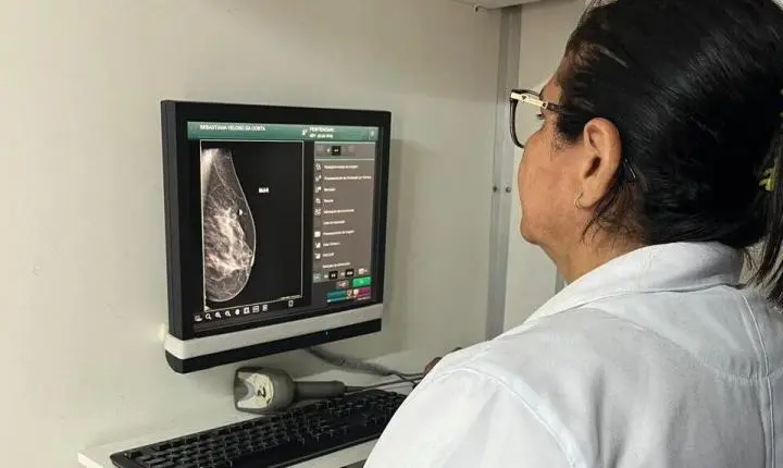 Câncer de mama: confira o passo a passo para fazer mamografia gratuita pelo SUS no Piauí